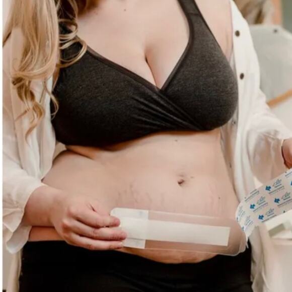 TWO Motif Medical C-Section Dressing System, Waterproof heal, protect NIB step 1 - Picture 2 of 4